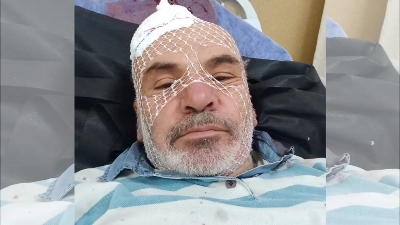 Nevşehir'de tadilat yaparken düşerek yaralandı