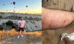 Nevşehir'de köpeğin saldırdığı turist rehberi yaralandı