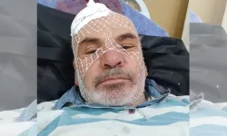 Nevşehir'de tadilat yaparken düşerek yaralandı