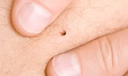 Nevşehir'de Ölümcül Tehlike! Sağlık Müdürü Uyardı