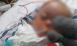 Nevşehir'de 1 yaşındaki bebek balkondan düştü
