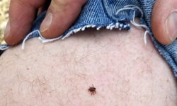 Nevşehir’de Kene Vakalarına Karşı Kritik Uyarı