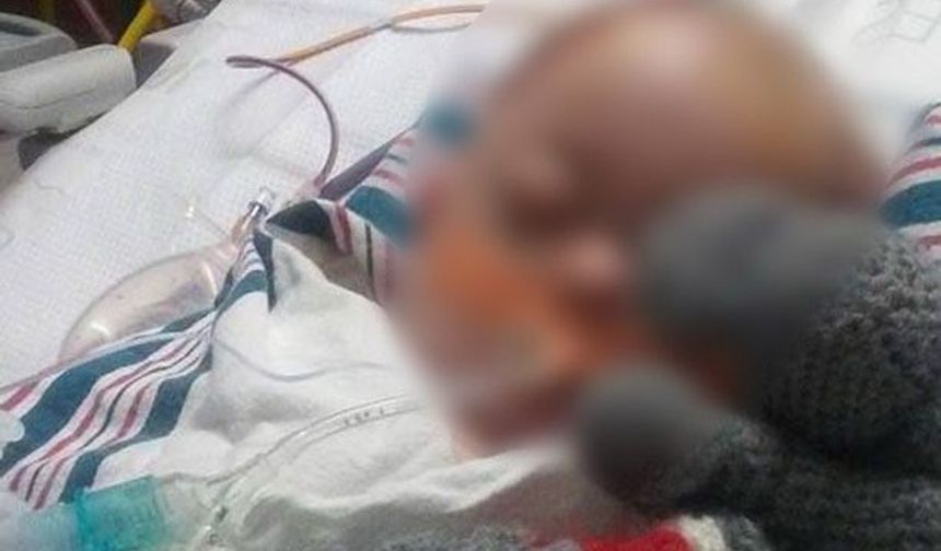 Nevşehir'de 1 yaşındaki bebek balkondan düştü