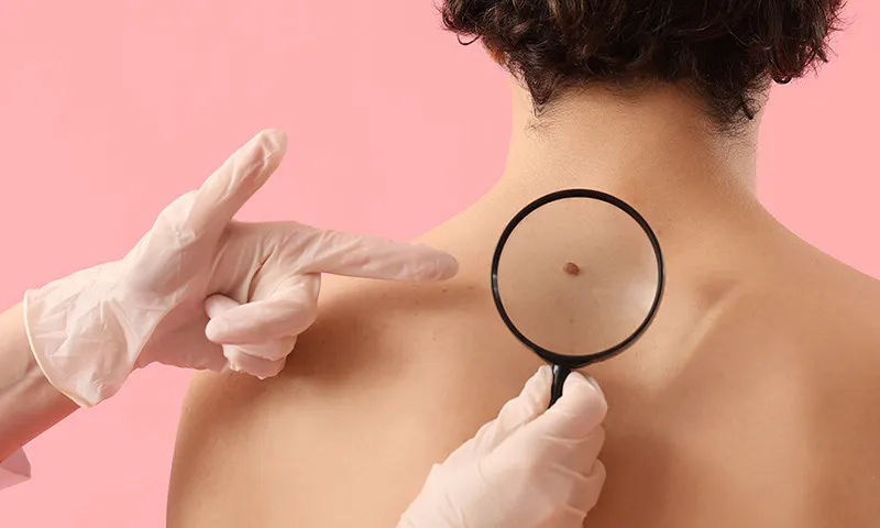 Cancer Screening Thumbnail